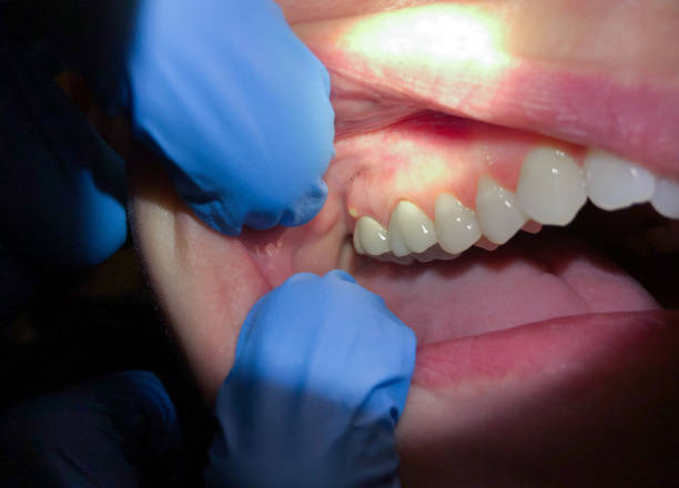 Best Emergency Treatment for Jaw Pain or Injury in Ferndale, MD
