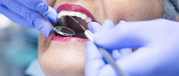 Best Emergency Treatment for Oral Infections in Ferndale, MD